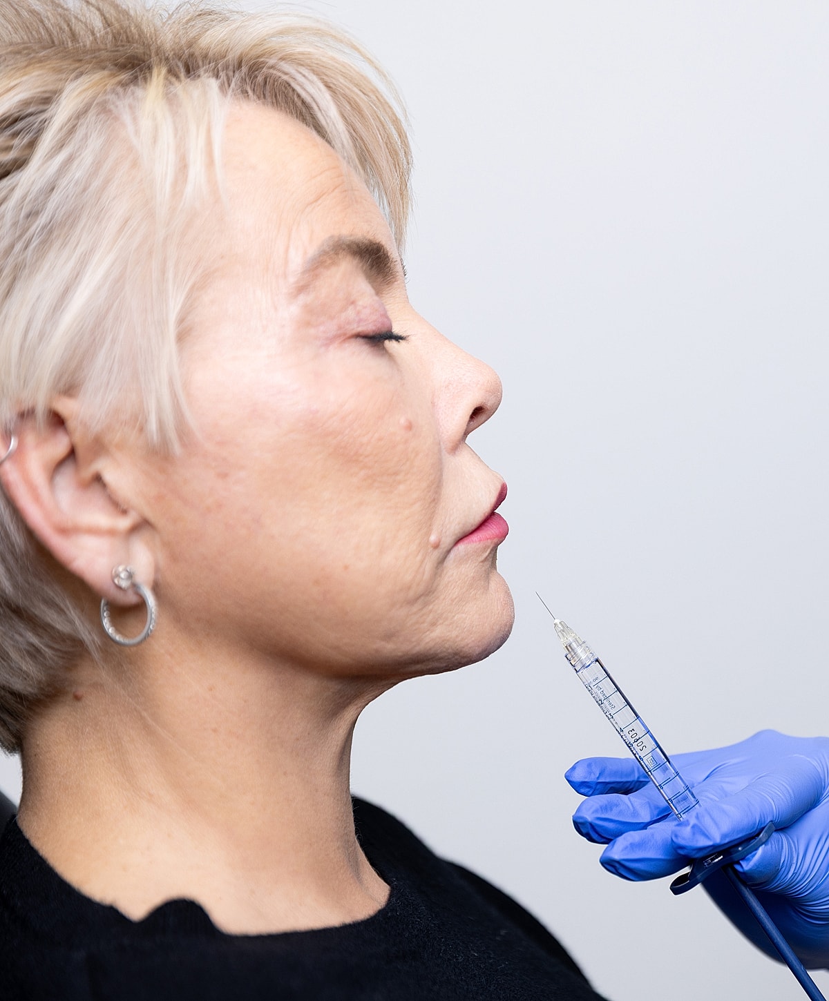 Woman receiving cosmetic injection treatment.