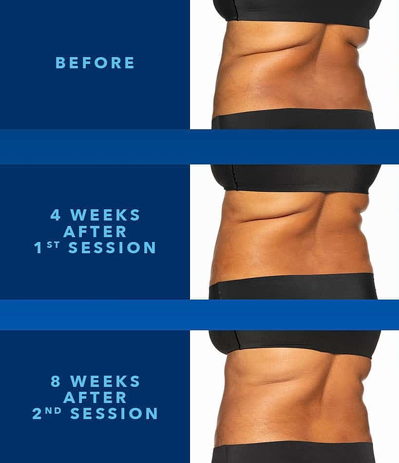 Body transformation before and after sessions