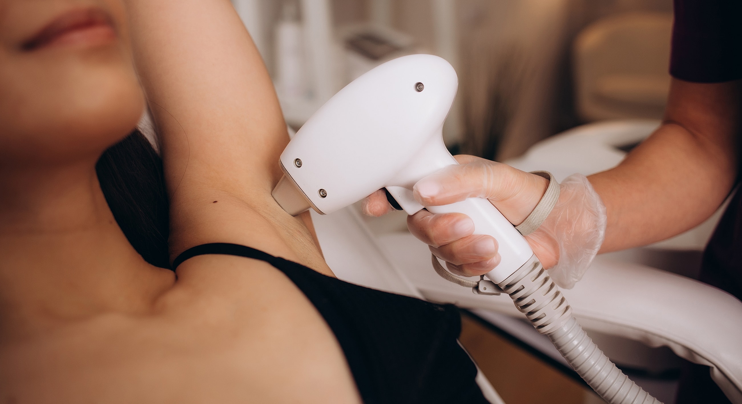 Laser hair removal procedure on underarm area.